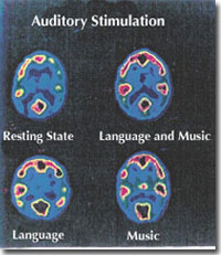 Auditory Stimulation